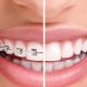 Ortodontik Meselelerin Sebepleri